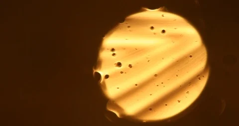 Tests Of Liquid Feces In A Under A Microscope Stock Footage 113179727