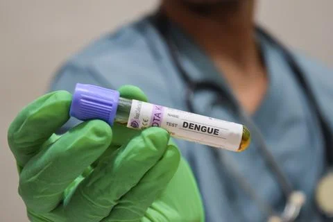 Text Dengue of is written on a bottle sample with background of a doctor Stock Photos