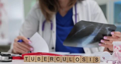 Text Tuberculosis of cubes and doctor examining X-ray image Stock Footage 310230042