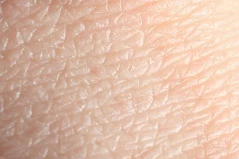 Texture of dry skin as background, macro view Stock Photos
