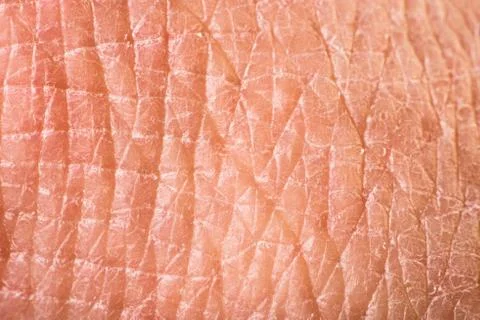 Texture of human skin Stock Photos