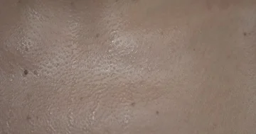 Texture of the skin close-up. Drops of sweat roll down the body. Stock Footage 86089595