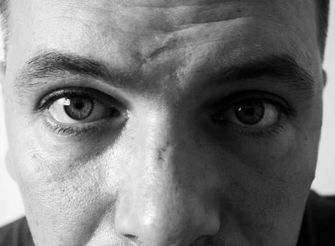 Texture of the skin of a man's face with scars and freckles, the eyes of a ma Stock Photos