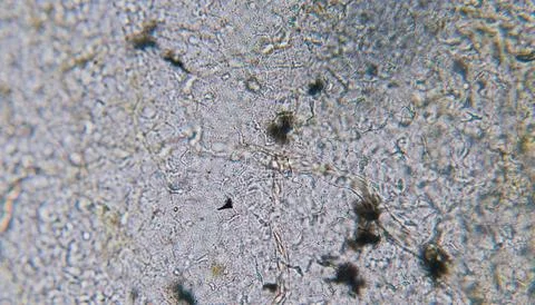 The texture of the surface of the microscope Stock Photos