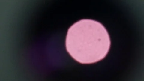 Tha look into the microscope at sample of blood Stock Footage 86274028