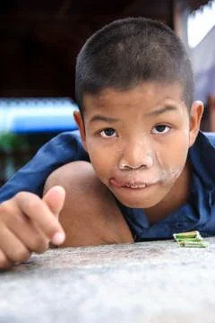 Thai disability boy Stock Photos