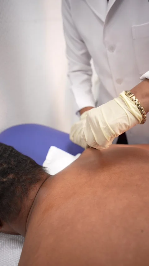 Therapeutic Treatment Procedure Video stock 314903005