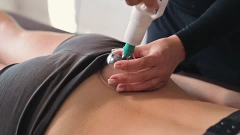 A therapist performs cupping therapy on a patient's back using a vacuum tool to Vídeo Stock 344379253