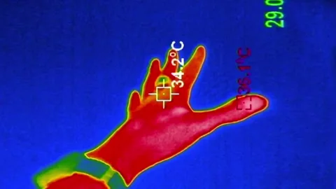 Thermal Imaging View of a Human Hand Moving and Flexing Video stock 315085549