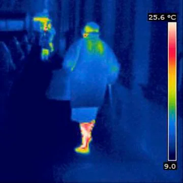 Thermogram Stock Photos