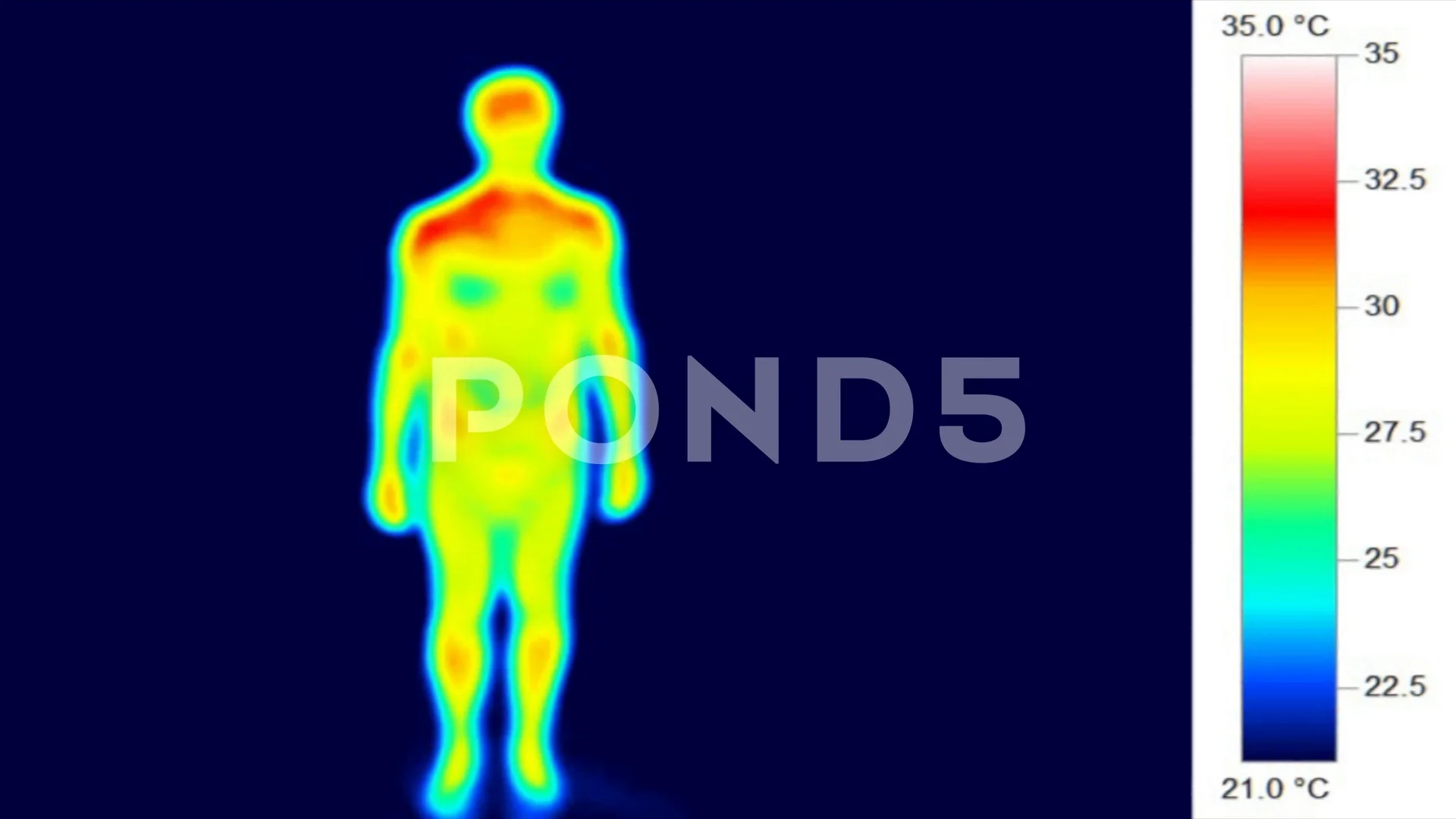 Thermography medical heat imaging, nude male body rotation