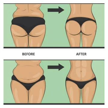 Thick and thin, overweight problems concept. Stock Illustration