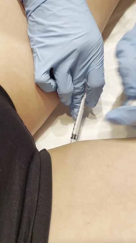 Thigh Fat Dissolving Injection Procedure Aesthetic Treatment  Stock Footage 310353898