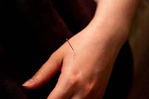 A thin acupuncture needle placed between index finger and thumb, put in place Stock Photos