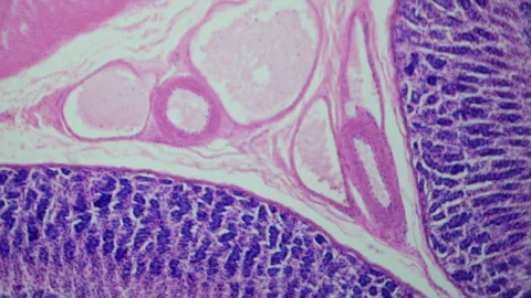 Thin section of human stomach with contrast under a microscope. Morphologic  Stock Footage 255678416