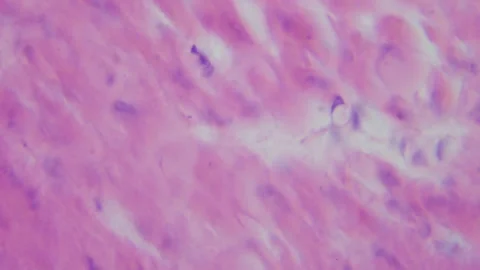 Thin section of human stomach with contrast under a microscope. Morphologic  Stock Footage 255678702