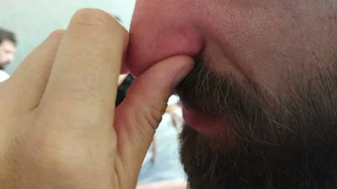 Thinking man rubbing his nose. Dermatology infection concept. Stock Footage 111503400