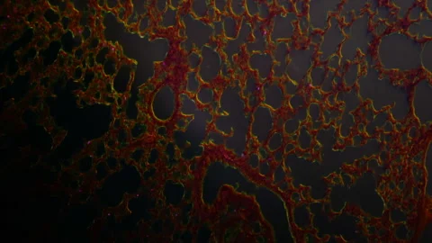 The thinnest section of a human lung under a microscope. Dark-field optical Stock Footage 252811196
