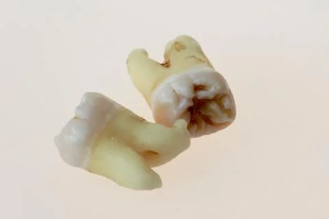 Third molars Stock Photos
