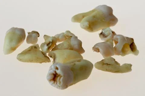 Third molars Stock Photos
