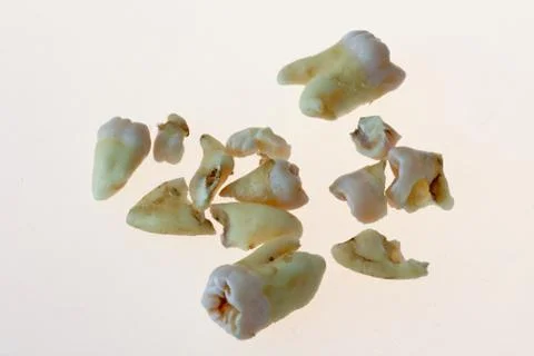 Third molars Stock Photos
