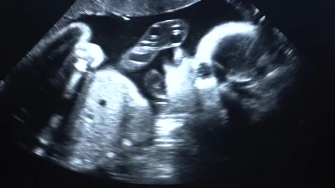 Third trimester pregnancy. Stock Footage 146688979