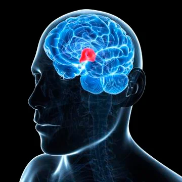 Third ventricle; artwork Stock Illustration