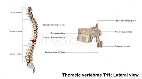 Thoracic Vertebrae T11 Lateral View: Graphic #80389541