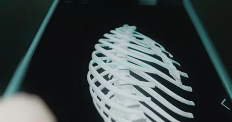 Thorax bones of female skeleton Stock Footage 313839176