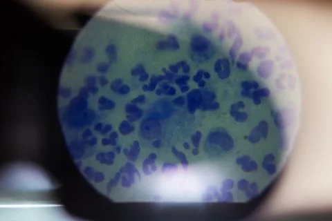 Thorough microscopic examination emphasizing leukocyte characteristics with Stock Photos