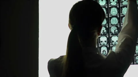 Thoughtful female doctor analyzing brain scan, medical research, difficult case Stock Footage