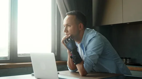 Thoughtful manager man with artificial limb joins hands Stock Footage 157535500