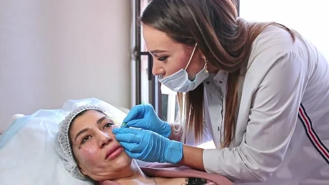Thread lifting is a cosmetological procedure for face rejuvenation. Stock Footage 201419313