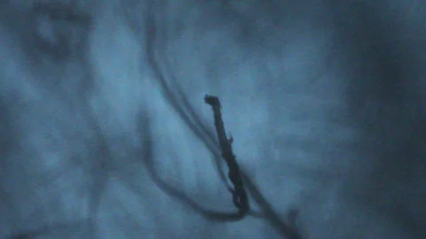 Threads filaments moving seen through an optical microscope Stock Footage 331772263