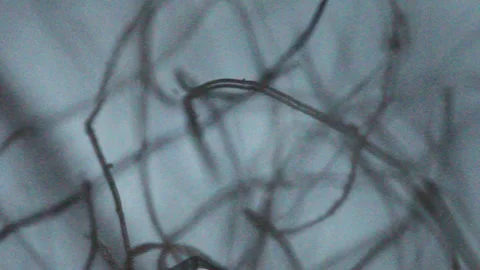 Threads lint moving seen with an optical microscope Stock Footage 331772039