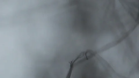 Threads lint seen with an optical microscope Stock Footage 331744113