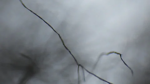 Threads moving seen through an optical microscope Stock Footage 331741451