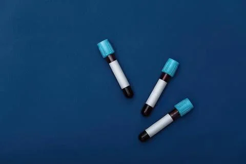 Three blood sample test tubes on blue background Stock Photos