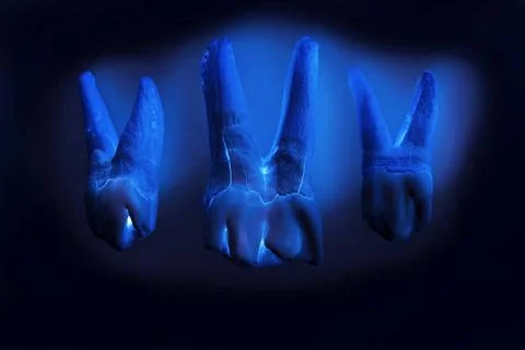 Three cow s teeth with roots on a black background. computer processing. t... Stock Photos