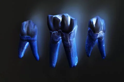 Three cow s teeth with roots on a black background. computer processing. t... Stock Photos