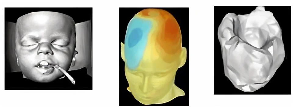 Three-Dimensional Models Highlighting Neural Activity and Facial Anatomy in.. Stock Photos
