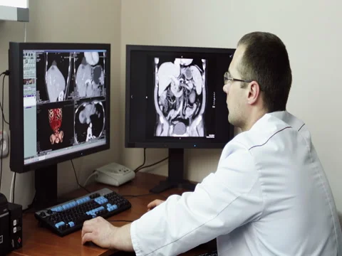 Three Doctors analyzing x-ray charts on the PC comp Stock Footage 73669959