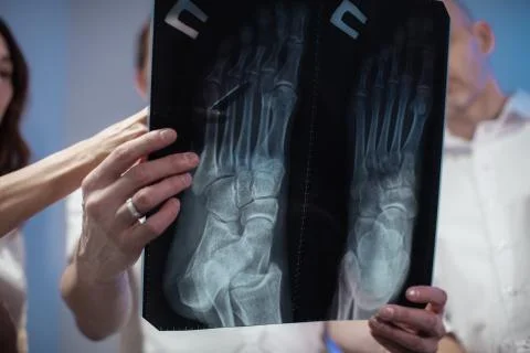 Three doctors look at an x-ray photo of a patient together Stock Photos