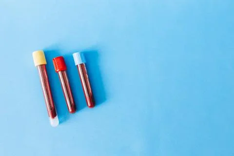 Three flasks with blood Stock Photos