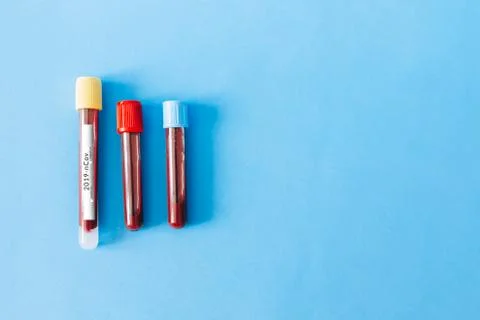 Three flasks with coronavirus Stock Photos