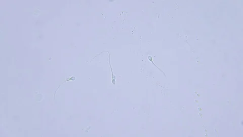 Three human sperms under Bright field Microscope Video stock 80258068