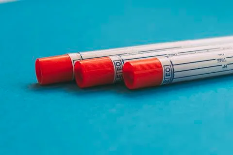 Three laboratory sample tubes with red cap on blue background Stock Photos