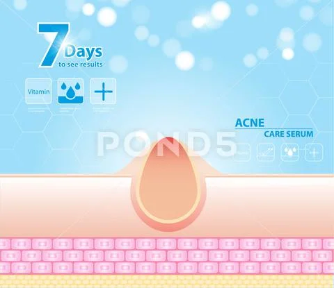 Three main layer of the human skin. skin aging stages diagrams ...