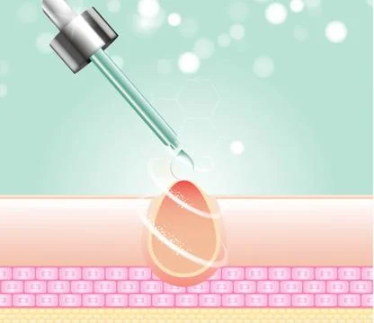 Three main layer of the human skin. skin aging stages diagrams. Stock Illustration
