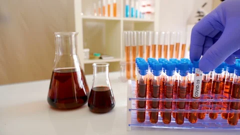 The three positive sample kit for the COVID-19 coronavirus Stock Footage 127946155